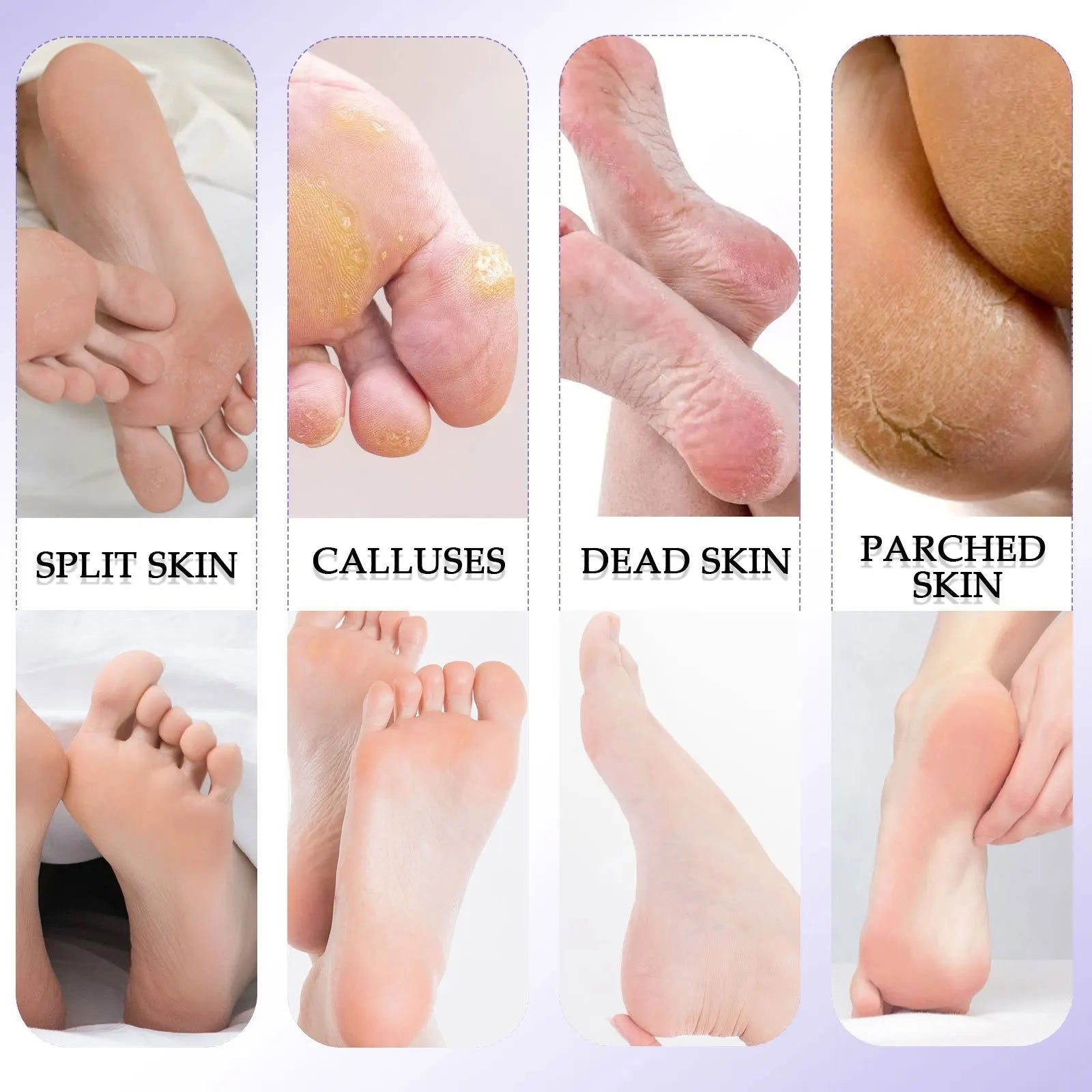 Pedicure Set Peeling and Exfoliating Calluses Foot Scrubbing Brush Stainless Steel Double-sided Foot Care Pedal Stone 10 in 1 - LOCKDEALZ