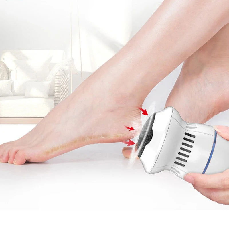 Pedicure Tools Professional Electric Foot Dead Skin Remover Feet Scrubber Callus Remover for Feet File Exfoliating Heels Grinder - LOCKDEALZ